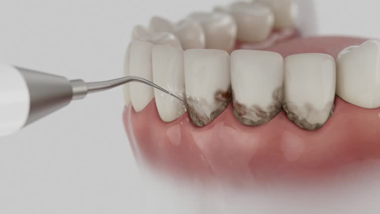 Reliable Tooth Extraction contractor in Joliet, IL by Smile Center Dentistry
